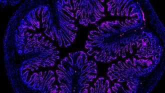 Ученые нашли новый способ лечения боли в кишечнике с помощью фермента бактерий и наночастиц