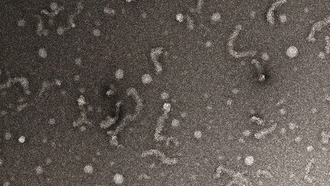 Химики раскрыли новые данные о белке, связанном с боковым амиотрофическим склерозом