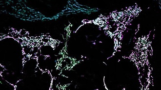 Новый инструмент позволяет визуализировать движение липидов внутри клетки