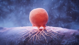 Снижение уровня липидов может замедлить рост рака груди