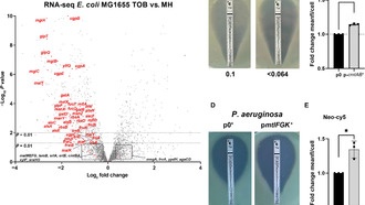 Ученые обнаружили, как аминогликозидные антибиотики проникают в бактерии
