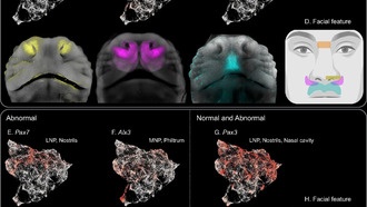 Ученые раскрыли клеточные «почтовые индексы», которые формируют человеческое лицо