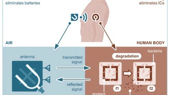 Ученые создали беспроводной имплантируемый датчик на основе модифицированных бактерий