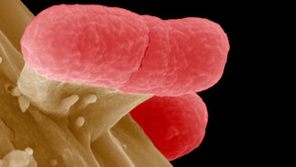 ИИ для предсказания устойчивости к антибиотикам может быть менее точным, чем считалось