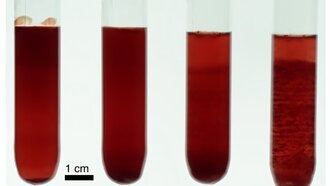 Ученые объяснили природу полос в пробирке с кровью и связали ее с диагностикой болезней