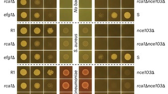 Устойчивый к лекарствам грибок Candida auris использует CO₂ для выживания на коже
