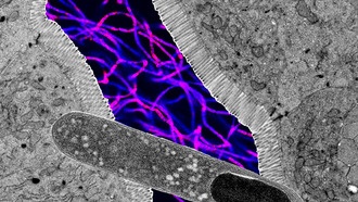 Бактерия Turicibacter в кишечнике защищает мышей от ожирения