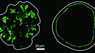 Ученые раскрыли механизм формирования протоков поджелудочной железы