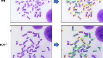 Искусственный интеллект научился считать хромосомные аномалии