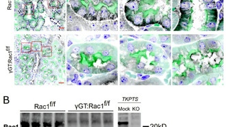 Белок Rac1 играет двойную роль в восстановлении повреждённой почки