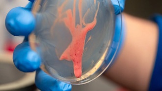 Учёные выяснили, как «слизистый» секрет бактерий вызывает увядание растений