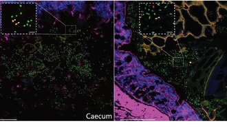Учёные выяснили, как бактерии в кишечнике обмениваются генами устойчивости к антибиотикам