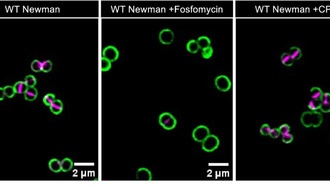 Белок иммунной системы может снижать эффективность антибиотиков