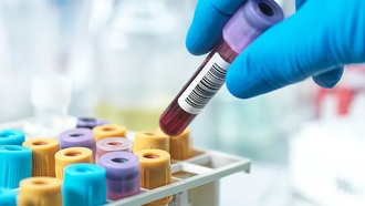 Китайские ученые создали первый в мире анализ крови для ранней диагностики рака легких