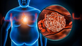 Ожирение по-разному влияет на здоровье мужчин и женщин